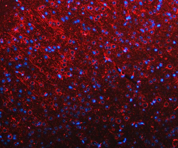RIMBP2 Rabbit Polyclonal Antibody