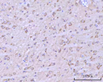 RIMBP2 Rabbit Polyclonal Antibody