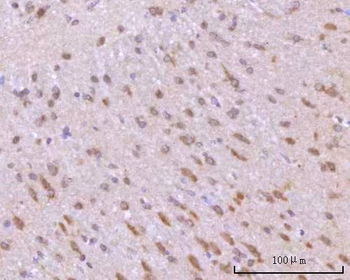RIMBP2 Rabbit Polyclonal Antibody