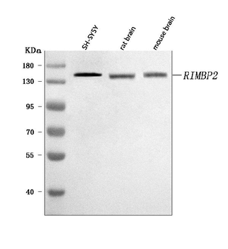 RIMBP2 Rabbit Polyclonal Antibody