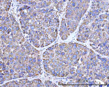 RPN1 Rabbit Polyclonal Antibody