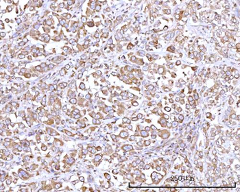 RPN1 Rabbit Polyclonal Antibody