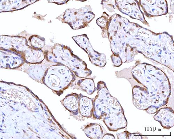RPN1 Rabbit Polyclonal Antibody