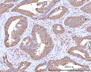 RPN1 Rabbit Polyclonal Antibody