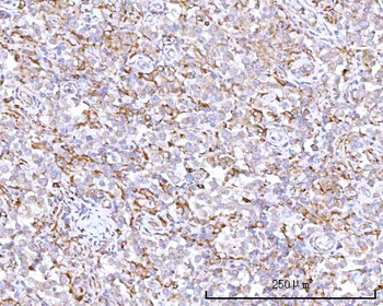 RPN1 Rabbit Polyclonal Antibody