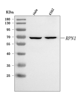 RPN1 Rabbit Polyclonal Antibody