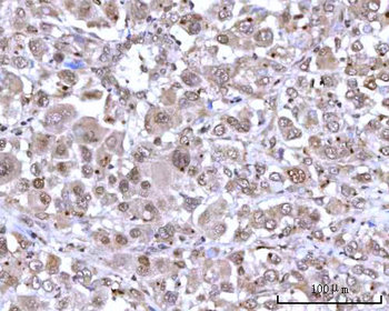 RNGTT Antibody