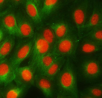 RBMY1A1 Rabbit Polyclonal Antibody