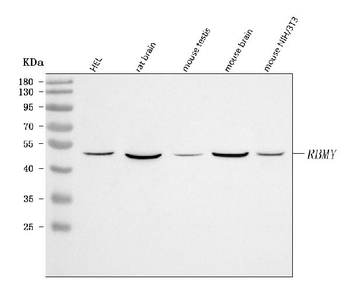 RBMY1A1 Rabbit Polyclonal Antibody