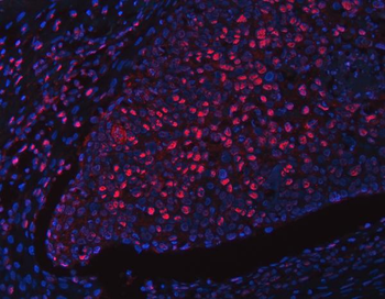 RFX1 Rabbit Polyclonal Antibody