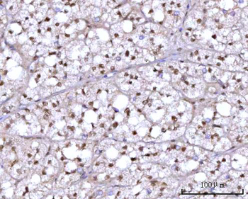 RFX1 Rabbit Polyclonal Antibody