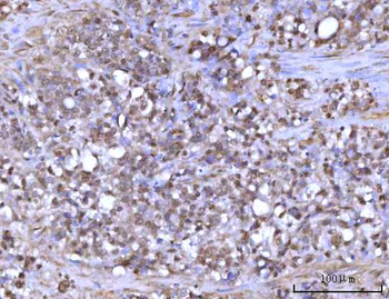 RFX1 Rabbit Polyclonal Antibody