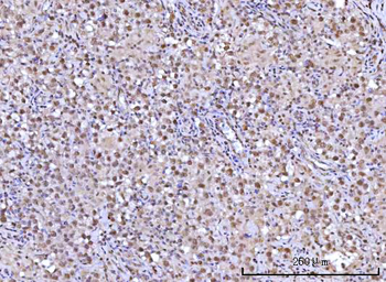 RFX1 Rabbit Polyclonal Antibody