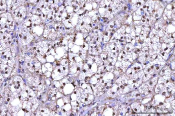 RNF34 Rabbit Polyclonal Antibody