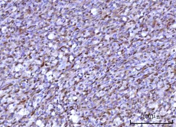 RNF34 Rabbit Polyclonal Antibody