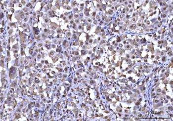 RNF34 Rabbit Polyclonal Antibody