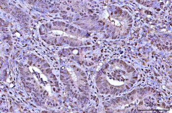 RNF34 Rabbit Polyclonal Antibody