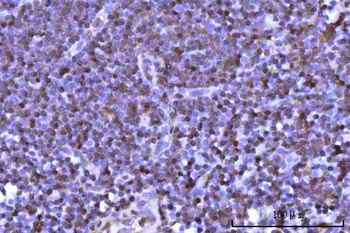 RNF34 Rabbit Polyclonal Antibody