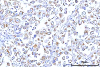 PTPIP51/RMDN3 Antibody