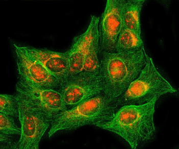 RASSF2 Rabbit Polyclonal Antibody