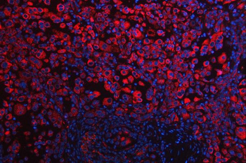 RPS5 Rabbit Polyclonal Antibody