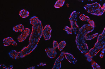 RPS5 Rabbit Polyclonal Antibody