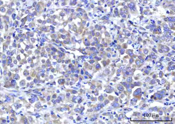 RPS5 Rabbit Polyclonal Antibody