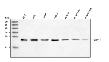 RPS5 Rabbit Polyclonal Antibody