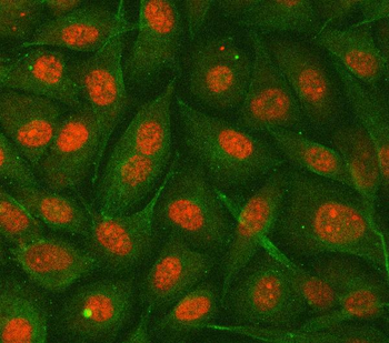 hnRNP E2/PCBP2 Rabbit Polyclonal Antibody