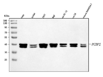 hnRNP E2/PCBP2 Rabbit Polyclonal Antibody