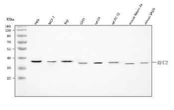 RFC2 Rabbit Polyclonal Antibody