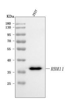 RBM11 Rabbit Polyclonal Antibody