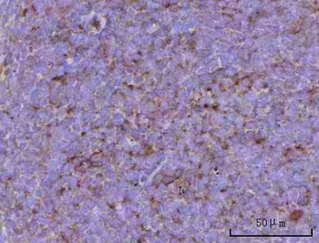 CD39/Entpd1 Rabbit Polyclonal Antibody