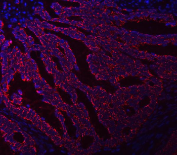 Asparagine synthetase/ASNS Rabbit Polyclonal Antibody