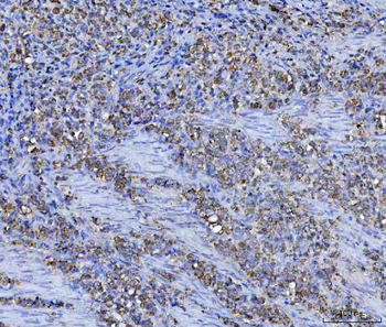 Asparagine synthetase/ASNS Rabbit Polyclonal Antibody