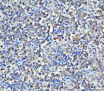 Asparagine synthetase/ASNS Rabbit Polyclonal Antibody