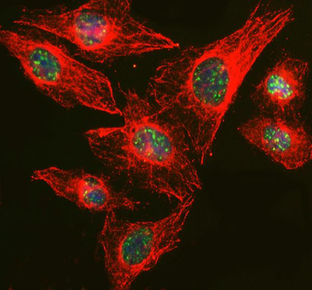 RBM25 Rabbit Polyclonal Antibody