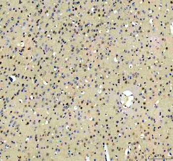 RBM25 Rabbit Polyclonal Antibody