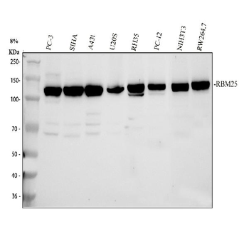 RBM25 Rabbit Polyclonal Antibody