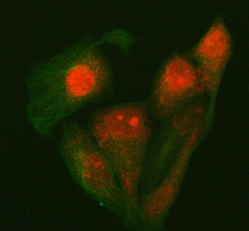 P15RS/RPRD1A Antibody