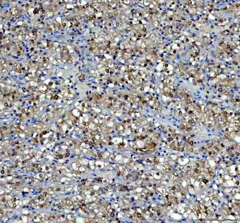 P15RS/RPRD1A Antibody