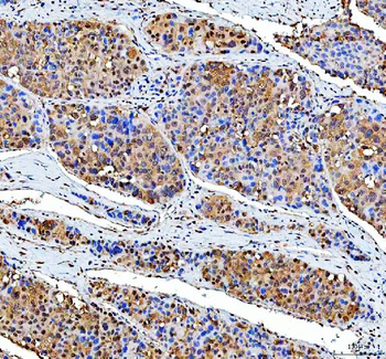 P15RS/RPRD1A Antibody