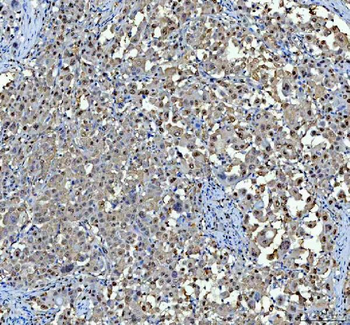 P15RS/RPRD1A Antibody