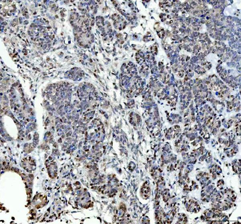 P15RS/RPRD1A Antibody