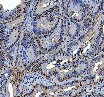 P15RS/RPRD1A Antibody