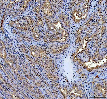 P15RS/RPRD1A Antibody
