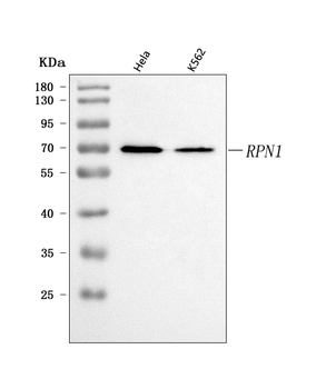 Ribophorin I/RPN1 Rabbit Polyclonal Antibody