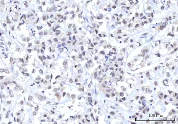 RBM22 Antibody