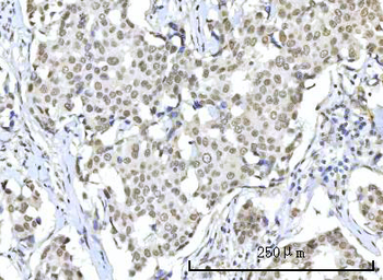 RBM22 Antibody