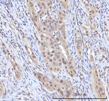 RANBP2 Rabbit Polyclonal Antibody